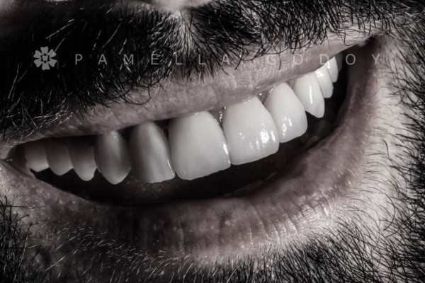 Imagem 2 das características para obter um sorriso bonito