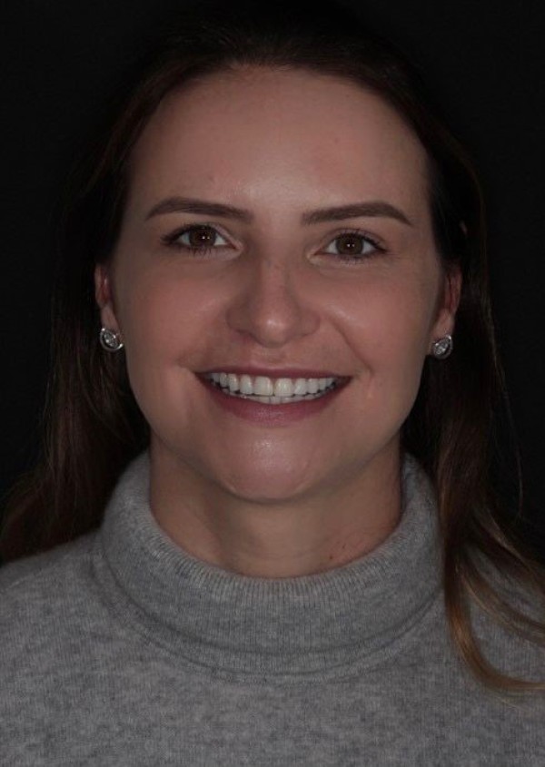 Antes de Idiara Lauck