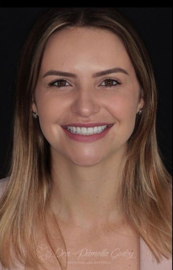 Depois de Idiara Lauck