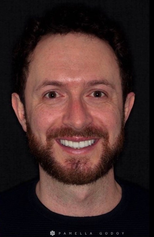 Depois de Marcelo Caralffini