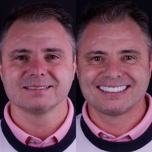 Antes e depois de Alencar