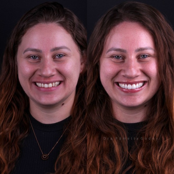 Antes e depois de Amanda