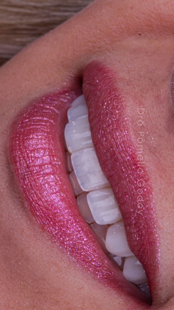 Imagem 4 das características para obter um sorriso bonito