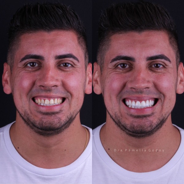 Antes e depois de Jeferson